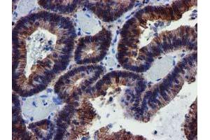 Image no. 3 for anti-Makorin Ring Finger Protein 1 (MKRN1) antibody (ABIN1499486)