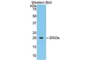 Western Blotting (WB) image for anti-Solute Carrier Family 12 (Sodium/Chloride Transporters), Member 3 (SLC12A3) (AA 867-1024) antibody (ABIN1859969) (SLC12A3 antibody  (AA 867-1024))