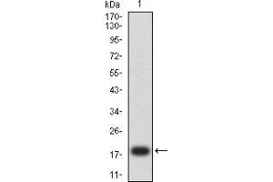 Western blot analysis using SERPINA1 mAb against human SERPINA1 (AA: 269-419) recombinant protein.