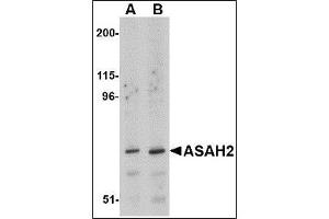 Western blot analysis of ASAH2 in 293 cell lysate with ASAH2 antibody at (A) 1 and (B) 2 µg/ml.