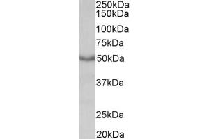 Western Blotting (WB) image for anti-Muscarinic Acetylcholine Receptor M1 (CHRM1) antibody (ABIN5924735) (CHRM1 antibody)