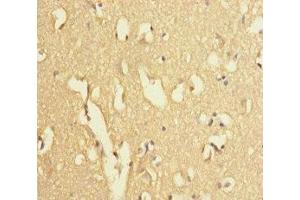Immunohistochemistry of paraffin-embedded human brain tissue using ABIN7174279 at dilution of 1:100 (USP2 antibody  (C-Term))