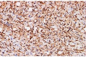 Immunohistochemistry of paraffin-embedded Human ovary using S100A11 Polyclonal Antibody at dilution of 1:200 (S100A11 antibody)
