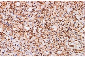 Immunohistochemistry of paraffin-embedded Human ovary using S100A11 Polyclonal Antibody at dilution of 1:200 (S100A11 antibody)