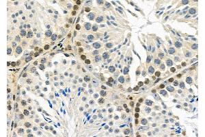 ABIN6260442 and ABIN6279228 at 1/100 staining Mouse testis tissue by IHC-P.