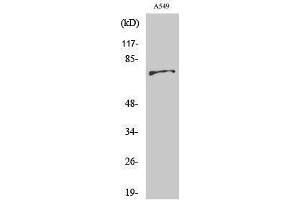 Western Blotting (WB) image for anti-BMX Non-Receptor Tyrosine Kinase (BMX) (Ser182) antibody (ABIN3174045) (BMX antibody  (Ser182))