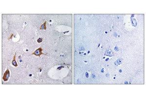 Immunohistochemistry (IHC) image for anti-Chondroitin Sulfate Synthase 1 (CHSY1) (Internal Region) antibody (ABIN1851106) (CHSY1 antibody  (Internal Region))