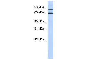 WB Suggested Anti-GPR75 Antibody Titration:  0. (GPR75 antibody  (Middle Region))