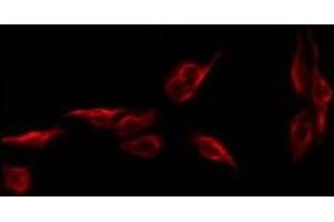 ABIN6279501 staining CoLo by IF/ICC. (NKX6-1 antibody  (Internal Region))