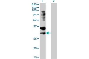 Western Blot analysis of TNFRSF14 expression in transfected 293T cell line by TNFRSF14 monoclonal antibody (M01), clone 2G6-2C7.