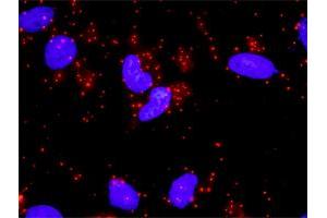 Proximity Ligation Analysis of protein-protein interactions between NFKB1 and STAT3. (STAT3 antibody  (AA 670-769))