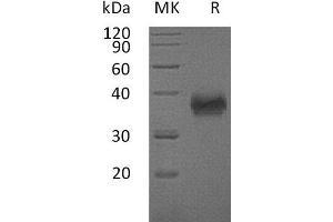 Western Blotting (WB) image for CD84 (CD84) protein (His tag) (ABIN7320706) (CD84 Protein (CD84) (His tag))