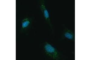 IF analysis of UBC12/UBE2M using anti-UBC12/UBE2M antibody (ABIN7600885).