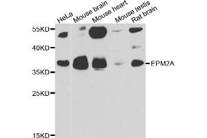 Western blot analysis of extracts of various cell lines, using EPM2A antibody (ABIN5974214) at 1/1000 dilution. (EPM2A antibody)