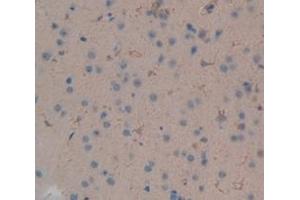 Figure. (JAK1 antibody  (AA 833-1074))