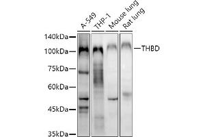 Western blot analysis of extracts of various cell lines, using THBD antibody (ABIN1683026, ABIN3018621, ABIN3018622 and ABIN6220518) at 1:1000 dilution. (Thrombomodulin antibody  (AA 200-500))