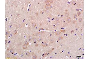 Formalin-fixed and paraffin embedded rat brain labeled with Anti-GLS2/LGA Polyclonal Antibody, Unconjugated (ABIN1714808) at 1:200 followed by conjugation to the secondary antibody and DAB staining (GLS2 antibody  (AA 41-140))