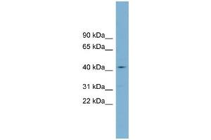 WB Suggested Anti-ZDHHC18  Antibody Titration: 0. (ZDHHC18 antibody  (Middle Region))
