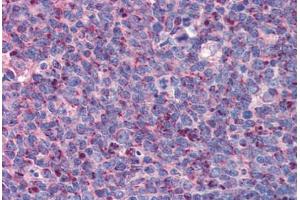 Human Tonsil: Formalin-Fixed, Paraffin-Embedded (FFPE) (IMP3 antibody  (C-Term))
