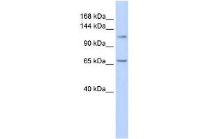 Western Blotting (WB) image for anti-Zinc Finger and BTB Domain-Containing Protein 10 (ZBTB10) antibody (ABIN2458201)