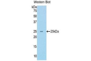 Western Blotting (WB) image for anti-RAD50 Homolog (S. Cerevisiae) (RAD50) (AA 400-595) antibody (ABIN1176803) (RAD50 antibody  (AA 400-595))
