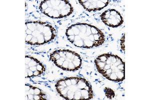Immunohistochemistry of paraffin-embedded mouse pancreas using SOX9 Rabbit pAb (ABIN1682861, ABIN5664083, ABIN5664085 and ABIN6219552) at dilution of 1:100 (40x lens). (SOX9 antibody  (AA 100-200))