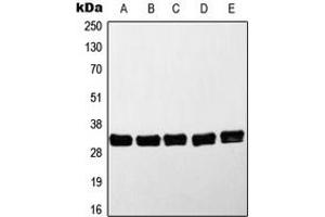 Western blot analysis of MYD88 expression in HeLa (A), Jurkat (B), K562 (C), Raji (D), Molt4 (E) whole cell lysates.