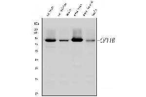 Western blot analysis of CPT1B using anti-CPT1B antibody (ABIN3042757).