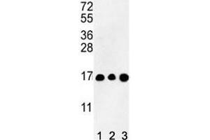 Western blot analysis of HIST3H3 antibody and (1) CEM, (2) K562, and (3) HL-60 lysate