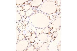 Immunohistochemistry (Paraffin-embedded Sections) (IHC (p)) image for anti-Programmed Cell Death 4 (PDCD4) (AA 121-149) antibody (ABIN657922)