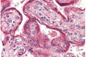 Human Placenta (formalin-fixed, paraffin-embedded) stained with OPN3 antibody ABIN399999 at 5 ug/ml followed by biotinylated goat anti-rabbit IgG secondary antibody ABIN481713, alkaline phosphatase-streptavidin and chromogen. (OPN3 antibody  (Internal Region))