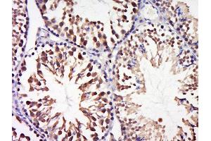 Paraformaldehyde-fixed, paraffin embedded mouse testis tissue, Antigen retrieval by boiling in sodium citrate buffer(pH6) for 15min, Block endogenous peroxidase by 3% hydrogen peroxide for 30 minutes, Blocking buffer (normal goat serum) at 37°C for 20min, Antibody incubation with Rabbit Anti-CCDC58 Polyclonal Antibody, Unconjugated  at 1:500 overnight at 4°C, followed by a conjugated secondary and DAB staining (CCDC58 antibody  (AA 71-144))