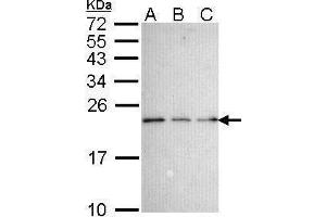 WB Image Sample (30 ug of whole cell lysate) A: 293T B: A431 , C: H1299 15% SDS PAGE antibody diluted at 1:1000