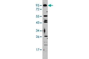 Western blot analysis of K-562 cell lysate (35 ug/lane) with Tlr6 polyclonal antibody . (TLR6 antibody  (C-Term))