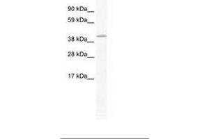 Image no. 1 for anti-GATA Binding Protein 5 (GATA5) (AA 321-370) antibody (ABIN202438) (GATA5 antibody  (AA 321-370))