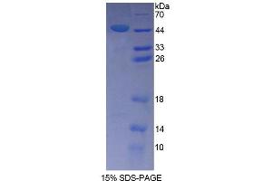 SDS-PAGE (SDS) image for Sperm Associated Antigen 1 (SPAG1) (AA 1-365) protein (His tag) (ABIN4989596)