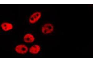 ABIN6278620 staining Hela by IF/ICC. (PER3 antibody  (Internal Region))