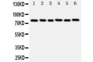Anti-B MyB antibody, Western blotting Lane 1: Rat Spleen Tissue Lysate Lane 2: Rat Thymus Tissue Lysate Lane 3: Rat Brain Tissue Lysate Lane 4: HELA Cell Lysate Lane 5: COLO320 Cell Lysate Lane 6: MCF-7 Cell Lysate