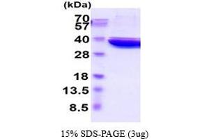SDS-PAGE (SDS) image for Lactate Dehydrogenase A (LDHA) (AA 1-332) (Active) protein (His tag) (ABIN6387821)