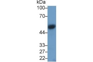 Detection of VEGFC in Rat Thymus lysate using Monoclonal Antibody to Vascular Endothelial Growth Factor C (VEGFC) (VEGFC antibody  (AA 108-223))