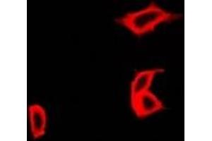 Immunofluorescent analysis of CCBL1 staining in Hela cells. (CCBL1 antibody)