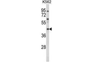 Western blot analysis of MC3R Antibody (Center) in K562 cell line lysates (35ug/lane).