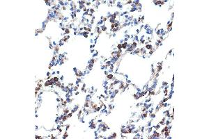 Immunohistochemistry of paraffin-embedded rat lung using ERp29 Rabbit mAb (ABIN7266943) at dilution of 1:100 (40x lens). (ERP29 antibody)