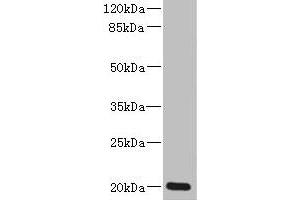 Western blot All lanes: ZMAT5 antibody at 5 μg/mL + Colo320 whole cell lysate Secondary Goat polyclonal to rabbit IgG at 1/10000 dilution Predicted band size: 20 kDa Observed band size: 20 kDa (ZMAT5 antibody  (AA 1-170))