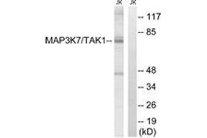 Western blot analysis of extracts from Jurkat cells, treated with heat shock, using MAP3K7 (Ab-187) Antibody.