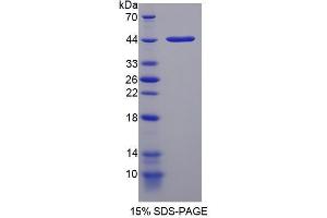 Image no. 1 for Neuromedin U (NMU) (AA 35-158) protein (His tag,GST tag) (ABIN4988582) (Neuromedin U Protein (NMU) (AA 35-158) (His tag,GST tag))