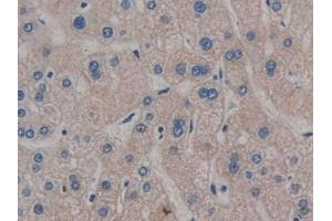 Immunohistochemistry (IHC) image for anti-Glycosylphosphatidylinositol Specific phospholipase D1 (GPLD1) (AA 496-840) antibody (ABIN7436591)