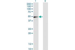 Western Blot analysis of GSDMD expression in transfected 293T cell line by GSDMDC1 monoclonal antibody (M01), clone 3F12-1B2. (GSDMD antibody  (AA 1-484))