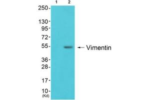 Western blot analysis of extracts from 293 cells (Lane 2), using Vimentin Antibody. (Vimentin antibody  (C-Term))