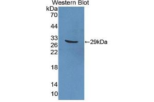 Western blot analysis of the recombinant protein. (PTPRN2 antibody  (AA 782-1001))